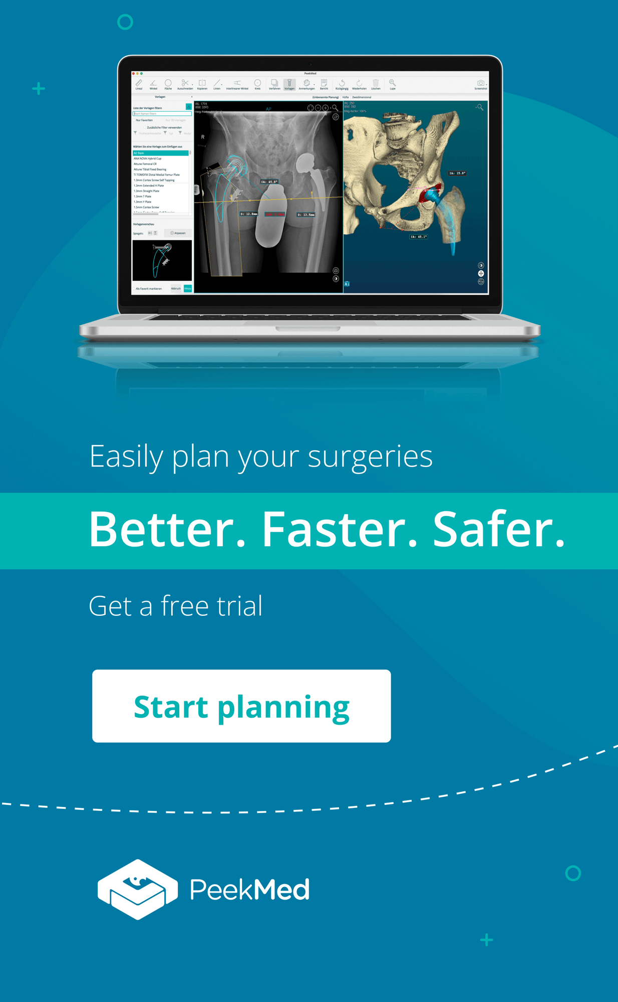 PeekMed® Blog Orthopedics and Healthcare technology